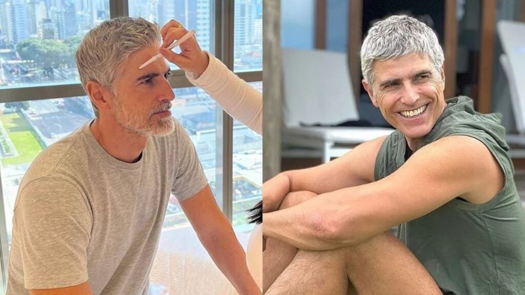 Reynaldo Gianecchini aplica botox e faz rejuvenescimento facial em clínica de São Paulo